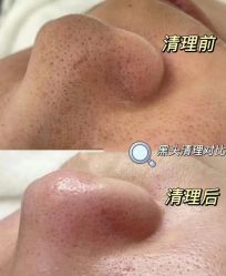 -Cream88颜皮肤管理中心