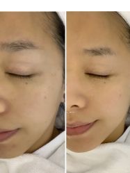 -痘敏医生专业祛痘·肌肤修复连锁