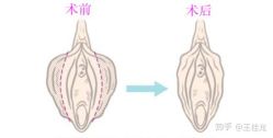 -邢台妇产医院