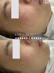 -KISS U 国际美学