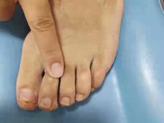 -世龙世家灰指甲鸡眼脚气甲沟炎跖疣护理(通州店)