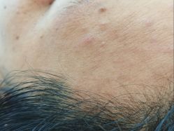 -蕾特恩专业祛痘·皮肤管理