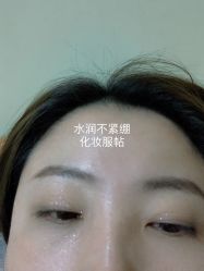 体验后-西安壹加壹医疗美容·西北抗衰旗舰店