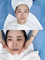 体验前-哈尔滨瑞丽医疗美容医院