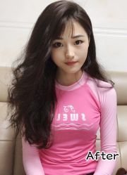 -小忠丽格医美
