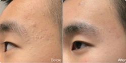 -SKINIST丽铂医疗美容