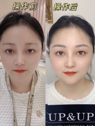 -UP&UP·半永久眉毛眼线机器野生眉