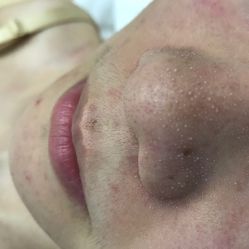 -新蝶变皮肤管理中心