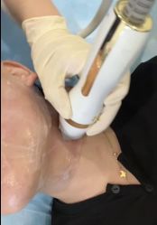 -杭州米兰柏羽医疗美容医院