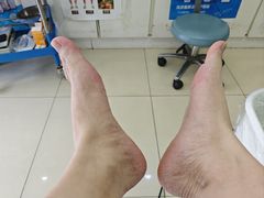 -朋朋修脚·灰指甲·甲沟炎·跖疣(人民路店)