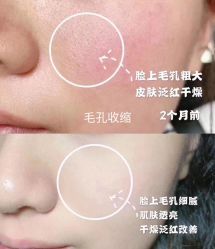 -Deeplus+韩国皮肤管理한국피부관리·C:Lab肌肤实验室