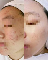 -康美贞·痘肌养护管理中心