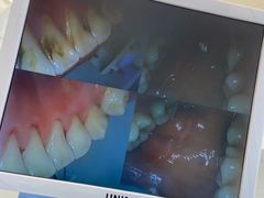 -诺贝尔一诺口腔医院(雁塔院区)