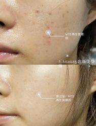 -E.beauty驻颜·痘敏肌调理中心