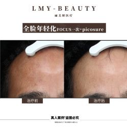 -丽美妍医疗美容·皮秒·立体分层抗衰