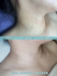 -清疣美疣·痣·斑净肤中心