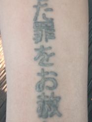 -天道专业洗纹身
