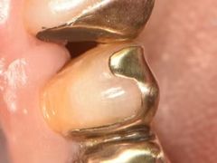 -精德口腔·种植修复·儿牙中心(财富中心店)