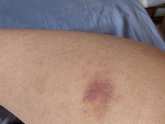 -上海市第十人民医院(总院)