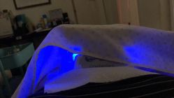 -肥三针腧穴瘦身馆