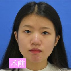 -广州健丽·去眼袋医疗美容机构