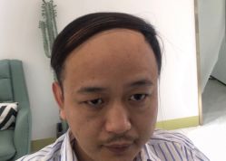 -发饰美男士增发补发假发定制店