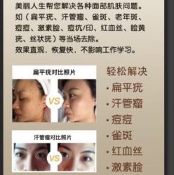 -美丽人生祛斑扁平疣汗管瘤中心