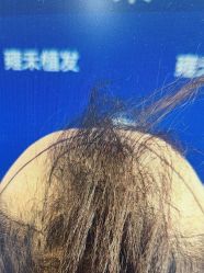 -雍禾植发全国连锁