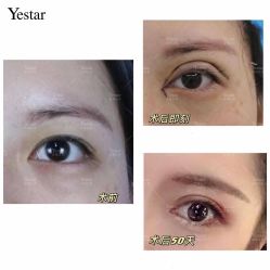 -Yestar艺星医疗美容医院