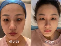 -针美汇欧邦医疗美容
