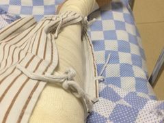 -佛山正骨骨科医院