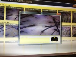 -菩叶头皮抗衰养发护发