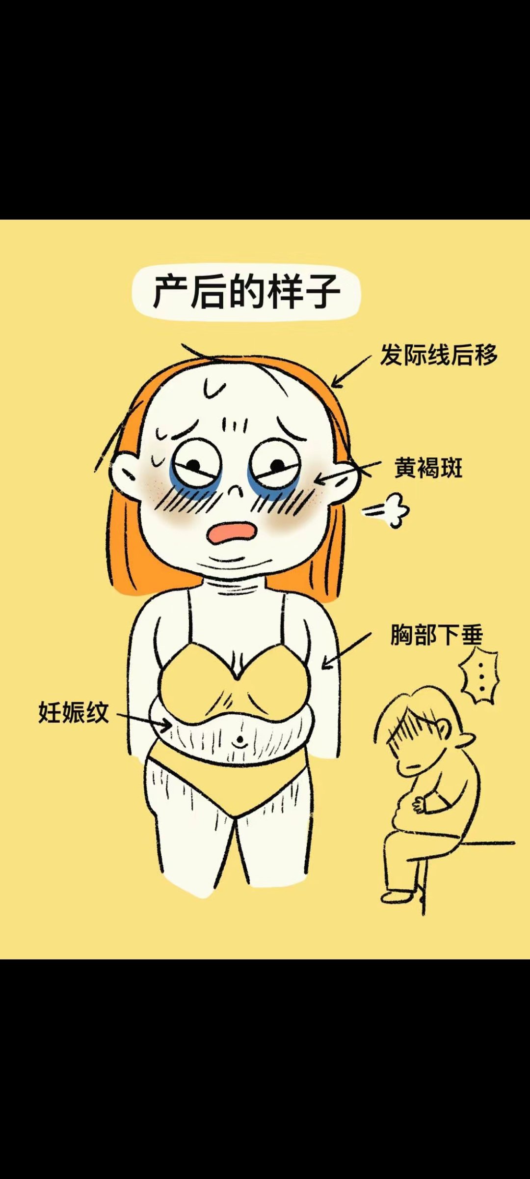 发际线后移图片漫画图片