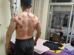 -沈师傅盲人按摩工作室(密三小区店)