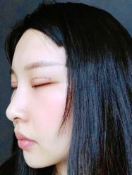 -广州美莱医疗美容医院