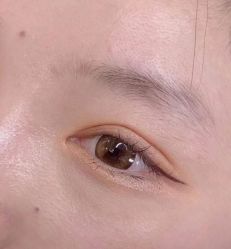 体验前-素妍医疗美容抗衰中心