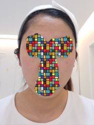 体验后-西美医疗美容门诊部