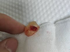 -Dr.Z dental仁康种植矫正中心