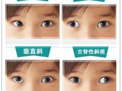 -上海大学附属上海和平眼科医院