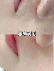 -美愈美肤MEIYU SKIN