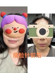 -上海玫瑰医疗美容医院