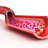 护血管、促循环，受益一辈子