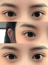 -铂特丽医美·眼鼻整形·光电美肤·注射抗衰