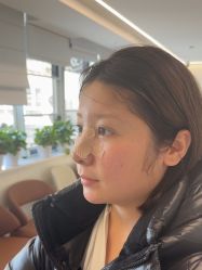 体验后-杭州美莱医疗美容医院