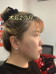 -深圳艺星医疗美容医院