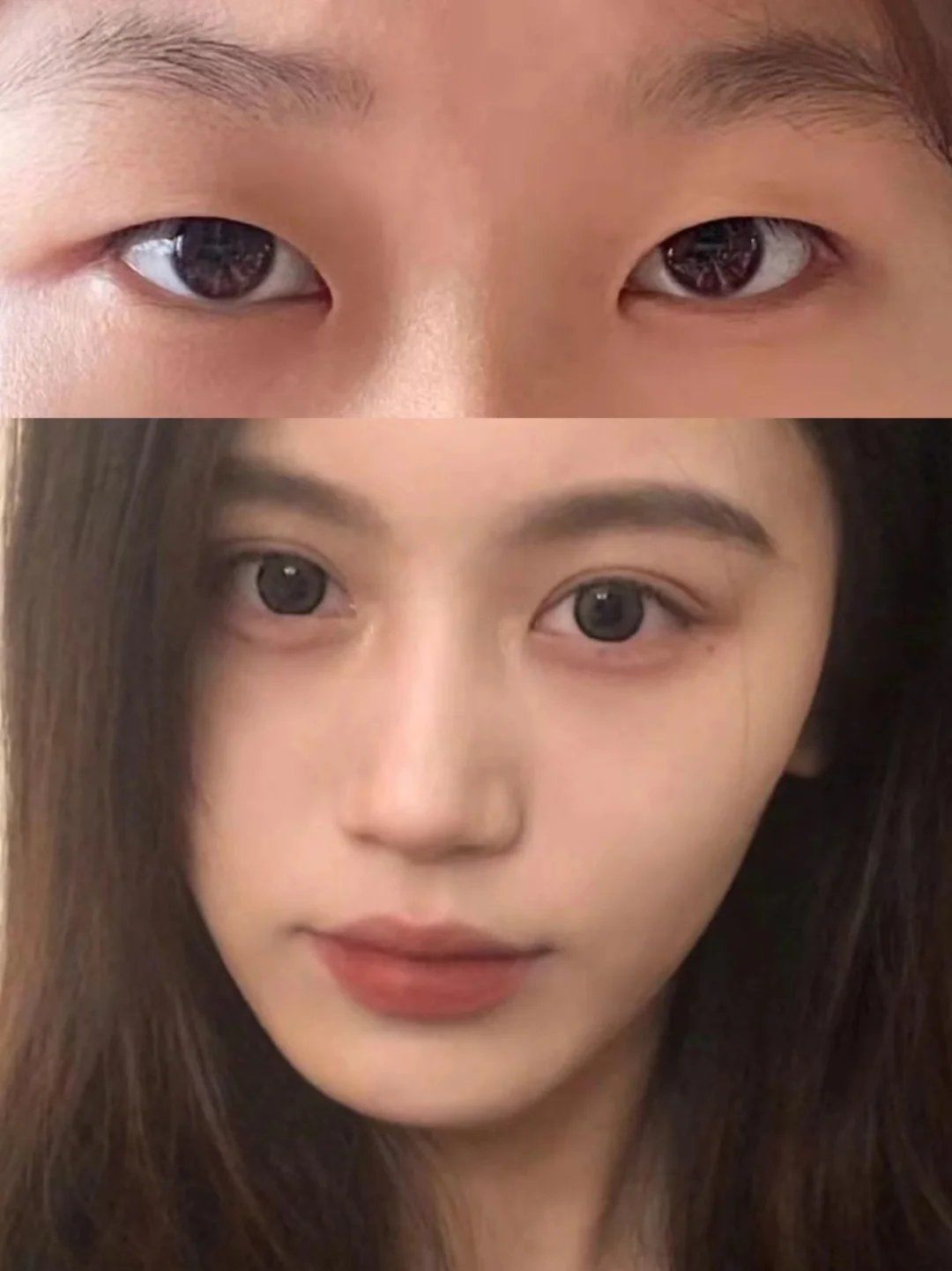 7mm 小开扇双眼皮,美翻啦!🧐