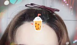 -大麦微针植发全国连锁