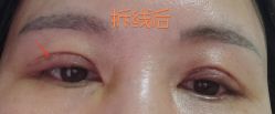 体验后-北京京通医院医疗美容