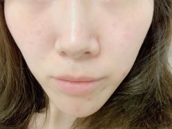 -VE专注问题肌·赛诺龙&科学美肤中心