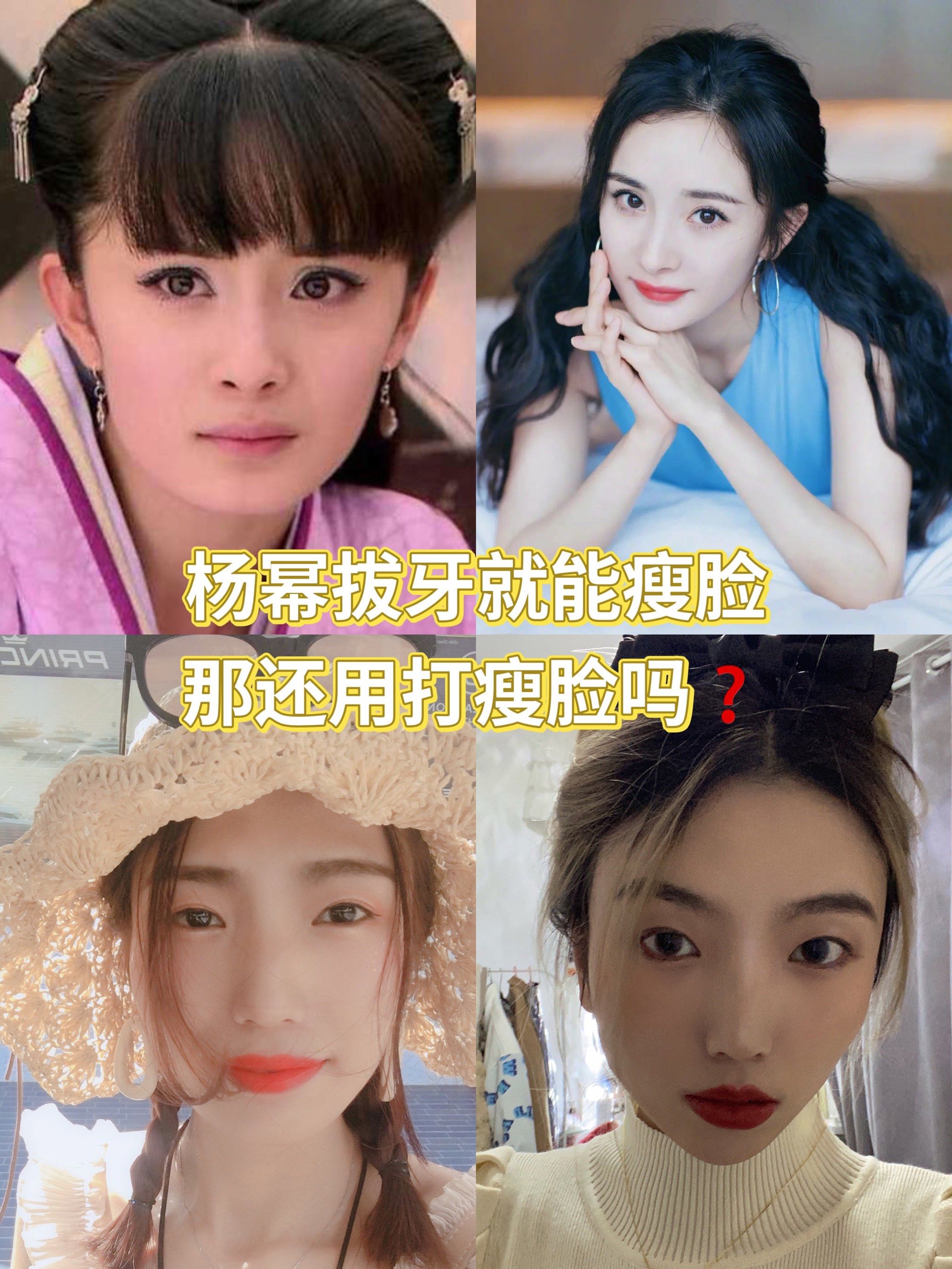 杨幂拔牙就能瘦脸真的假的